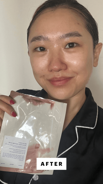 Han after using the Dr. Althea Jelly Seal Dewy Mask